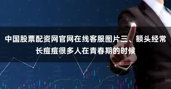 中国股票配资网官网在线客服图片三、额头经常长痘痘很多人在青春期的时候